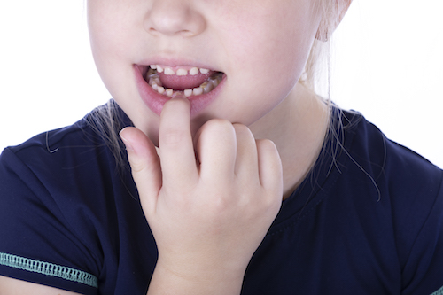 Foto descrittiva di quali sono i denti da latte